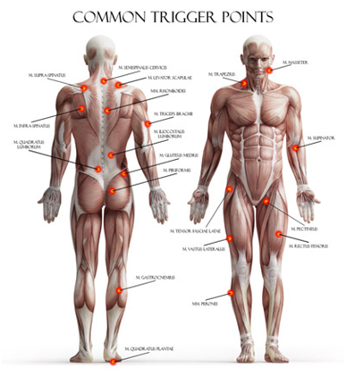 Trigger Point Injections - Motion Is Medicine