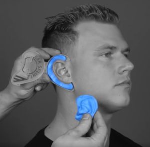 Preventing Cauliflower Ear - Motion Is Medicine